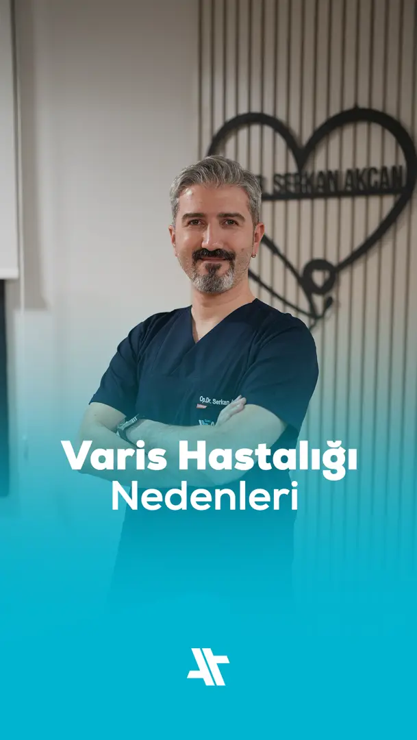 Varis Hastalığı Nedenleri